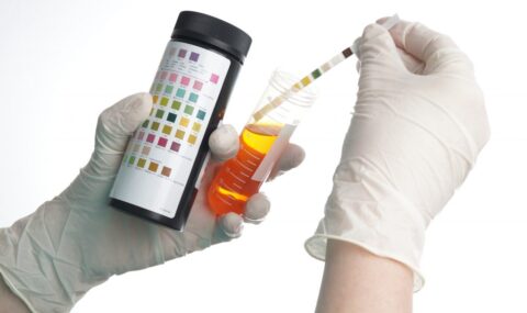 ketones-ketosis-and-ketoacidosis-1-1024x682